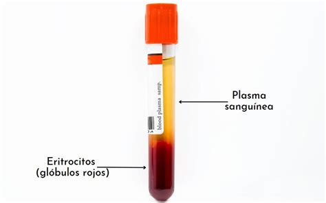 plasma sanguíneo - plasma